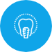 Teeth Whitening - Bleaching